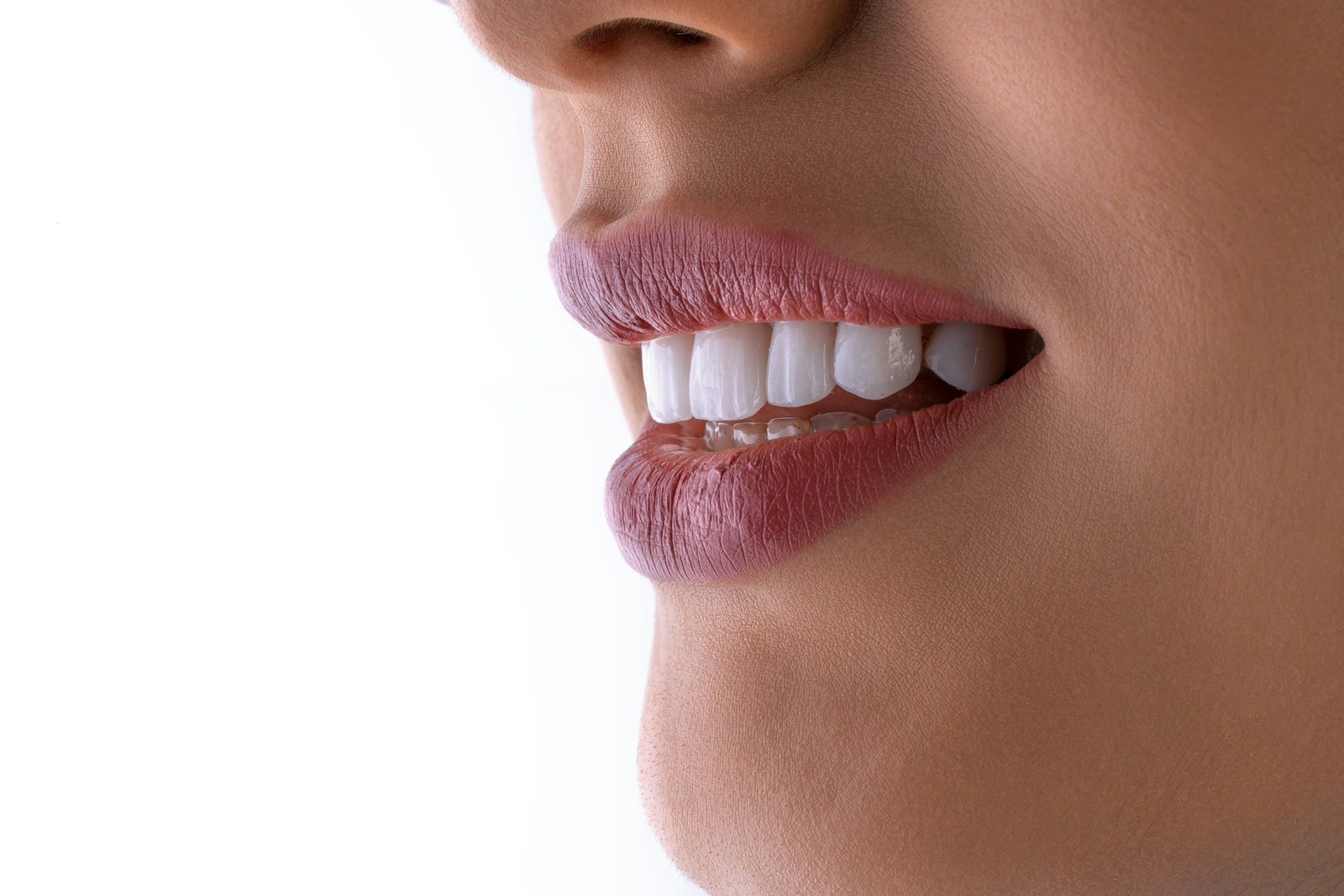 Close-up of a healthy, natural smile with bright white teeth